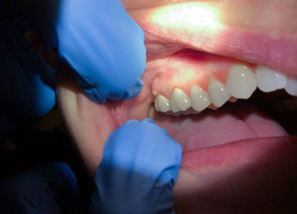 Best Pediatric Emergency Dentist in Cheney, WA