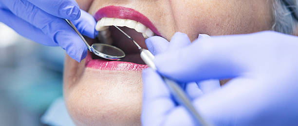 Best Emergency Treatment for Dental Infections or Abscesses in Cheney, WA